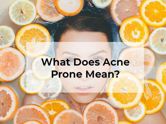 What Does Acne Prone Mean