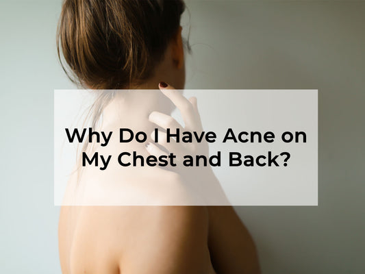 Why Do I Have Acne on My Chest and Back?